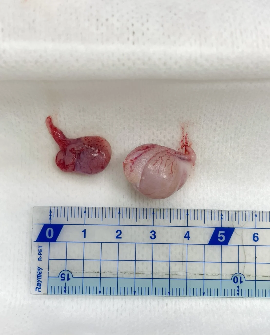 腹腔隱睪5