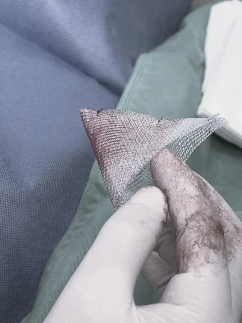 prolene_mesh2