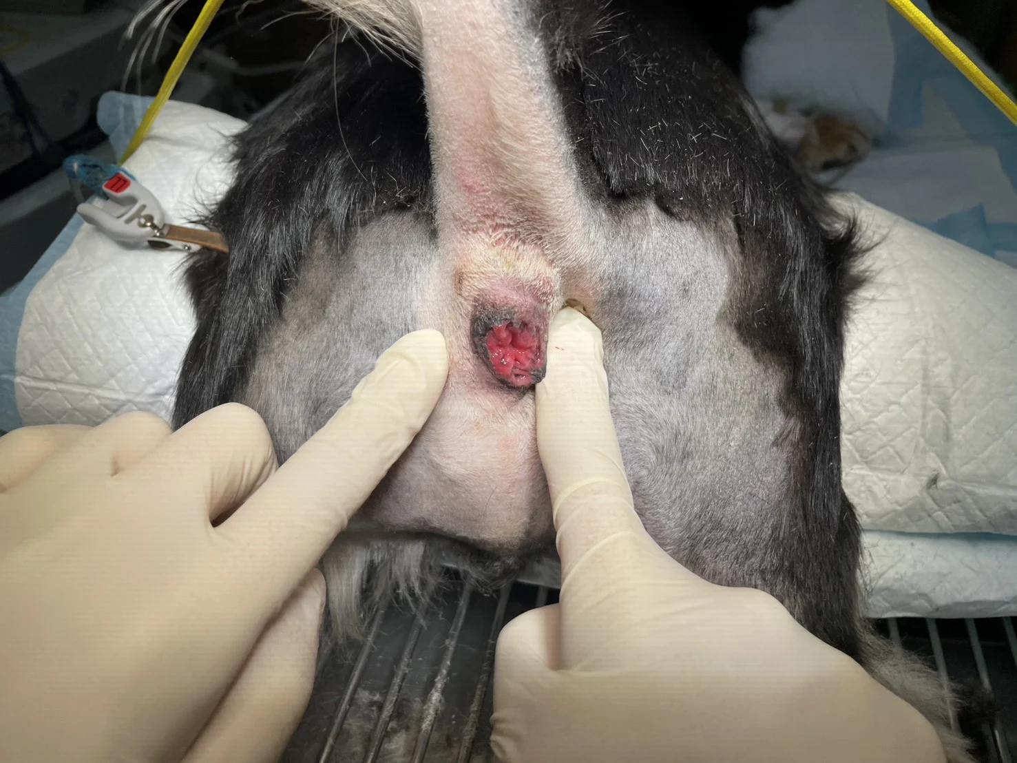 prineal_hernia1