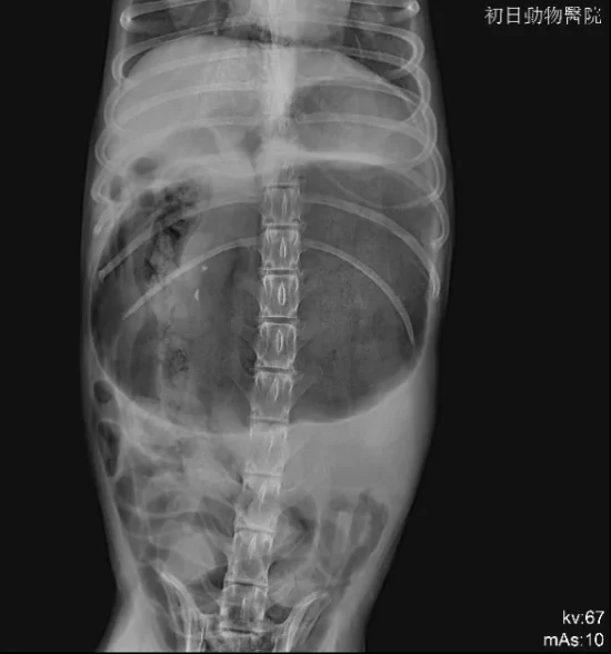 xrayAP-stomach-gas